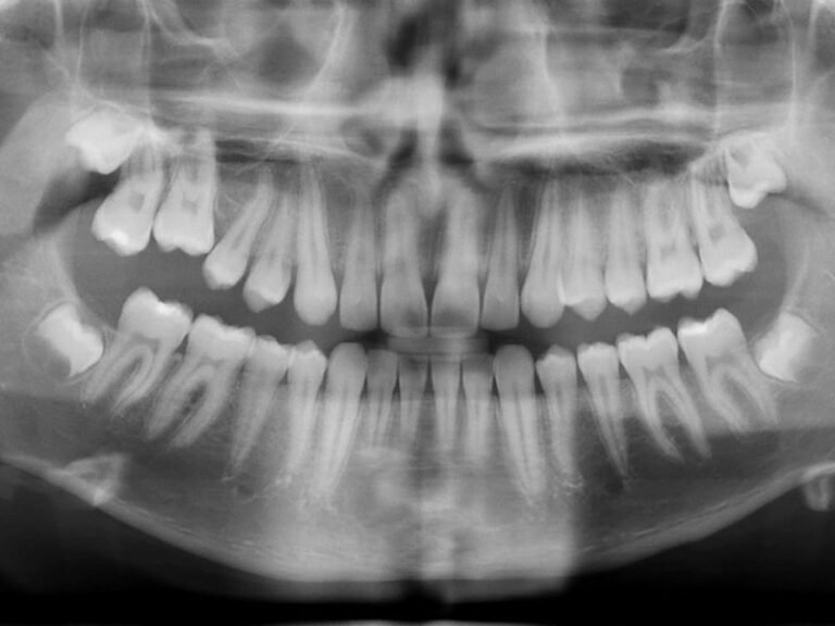 radiografia dental en un ambiente clinico